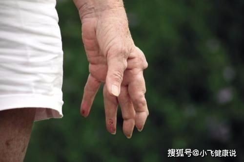 口腔潰瘍反復發(fā)作,或許是這6種疾病的預示,別忽視